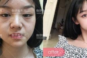 大连爱德丽格医疗美容医院刘志刚皮肤美容怎么样附最新价格表