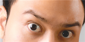 埋线双眼皮的手术操作是什么样的？埋线双眼皮又适用哪类人群呢？