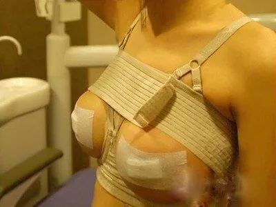 乳房再造术前准备都有哪些呢？