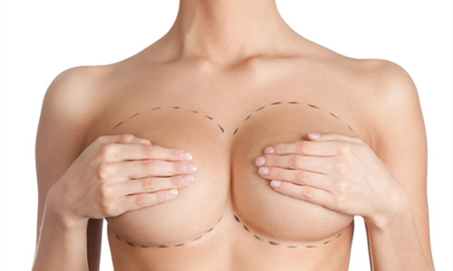 广东省潮州市网友关于丰胸手术图片的咨询