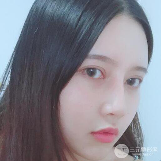 宜昌美岸医疗美容李英华自体脂肪面部填充怎么样？真人日记曝光