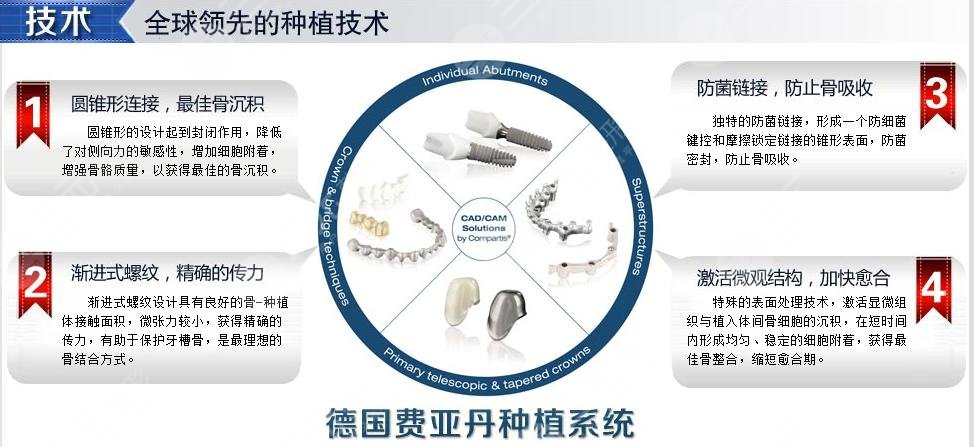 种植牙品牌排行榜价格