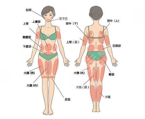 上海长征医院整形外科袁湘斌医生吸脂科普