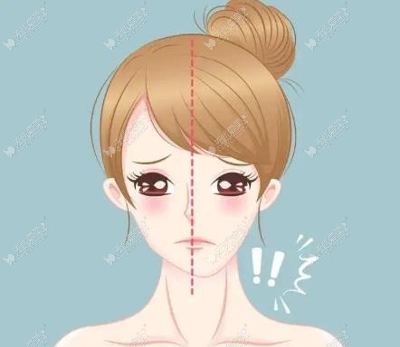 南宁爱思特做偏颌矫正手术价格 南宁爱思特做偏颌矫正手术价格