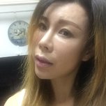 在深圳做了4次激光祛斑的恢复效果,真的干净了
