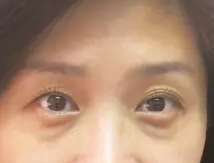 术前图片 术前图片