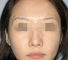 术后图片 术后图片