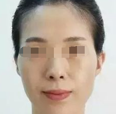 术前图片 术前图片