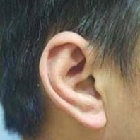 术后图片 术后图片