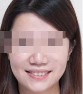 术后图片 术后图片