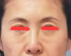 术前图片 术前图片