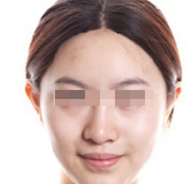 术后图片 术后图片
