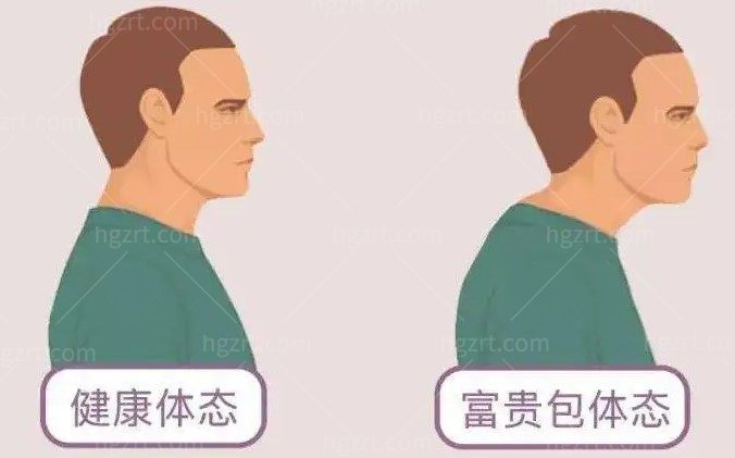 国内治疗富贵包的专科医院哪个好 国内治疗富贵包的专科医院哪个好