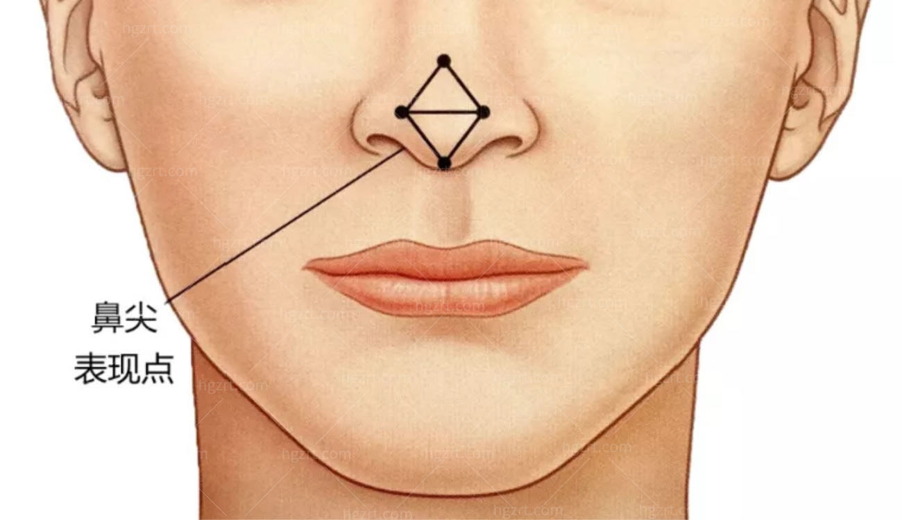 韩国隆鼻整形术.jpg 韩国隆鼻整形术.jpg