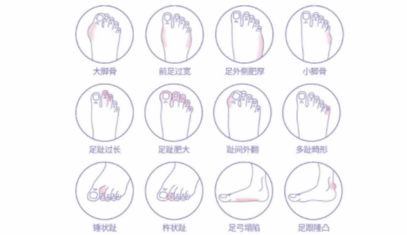 北京马文足科整形怎么样.jpg 北京马文足科整形怎么样.jpg