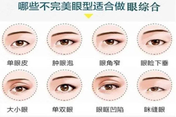 什么人适合做眼综合手术 什么人适合做眼综合手术