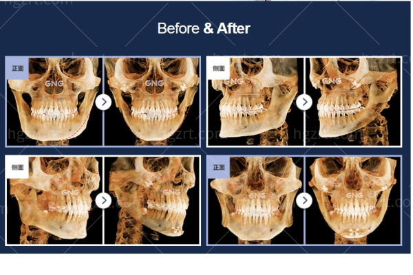 韩国轮廓哪里做得好?当地亲评韩国gng整形医院轮廓三件套绝绝子! 韩国轮廓哪里做得好?当地亲评韩国gng整形医院轮廓三件套绝绝子!