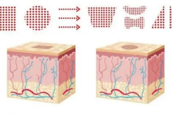 现在流行的医美项目有哪些?这几种热门项目分享,爱美者一定要知道 现在流行的医美项目有哪些?这几种热门项目分享,爱美者一定要知道