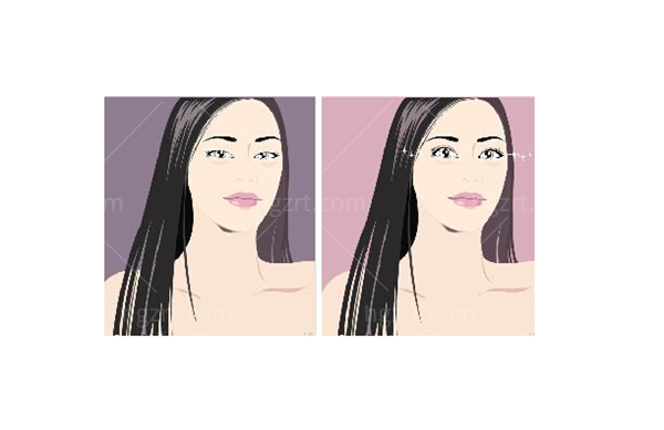 贵阳甄美姬医疗美容双眼皮卡通图片 贵阳甄美姬医疗美容双眼皮卡通图片