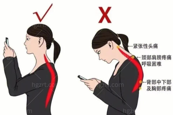 如何测试自己是否有富贵包 如何测试自己是否有富贵包