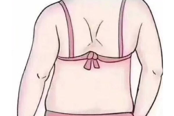 背部抽脂价格贵吗 背部抽脂价格贵吗