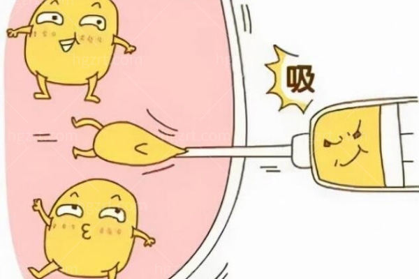 吸脂减肥会不会出现反弹?很想吸脂又怕对身体有副作用 吸脂减肥会不会出现反弹?很想吸脂又怕对身体有副作用