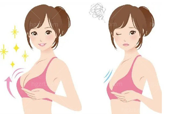 自体脂肪隆胸多少钱 自体脂肪隆胸多少钱