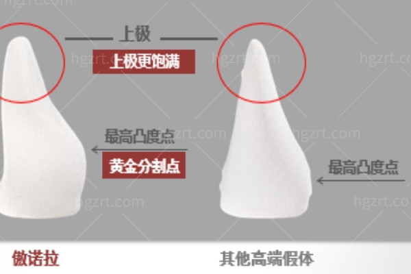 奥若拉假体隆胸多少钱 奥若拉假体隆胸多少钱