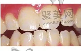 WechatIMG7960