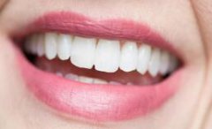 带你了解舌侧牙齿矫正的详细步骤，专业解答