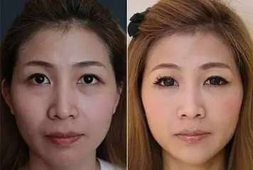 美容绣眉想做个普通的预算多少? 美容绣眉想做个普通的预算多少?