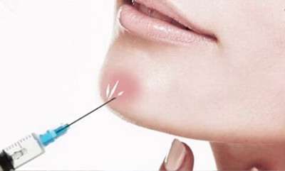 祛痘价格大概是多少? 祛痘价格大概是多少?