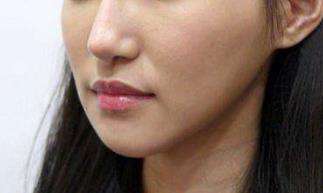 鞍山张玉霞医疗美容机构 价格表权威一览