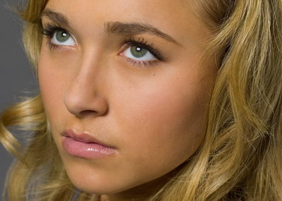 激光祛斑收费如何? 激光祛斑收费如何?