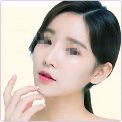 注射隆鼻大约需要多少钱? 注射隆鼻大约需要多少钱?