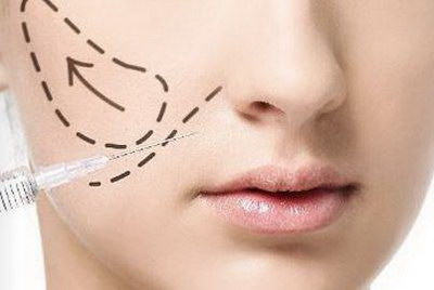 上海激光祛斑整形医生排行榜(2022最新排名) 上海激光祛斑整形医生排行榜(2022最新排名)