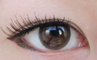 溶脂去眼袋优惠价格_大概需要多少钱? 溶脂去眼袋优惠价格_大概需要多少钱?