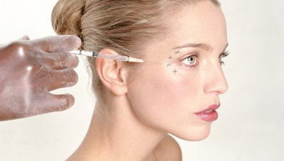 玻尿酸去鱼尾纹收费明细_具体多少钱? 玻尿酸去鱼尾纹收费明细_具体多少钱?