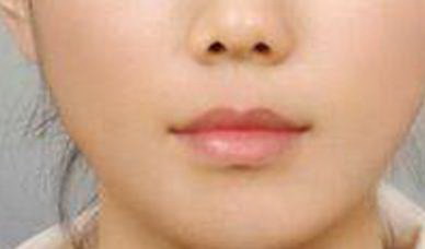 长沙热玛吉整形医生排名分析 长沙热玛吉整形医生排名分析