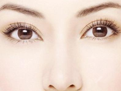 做双眼皮费用一般是多少 上海艺星许炎龙做双眼皮效果如何