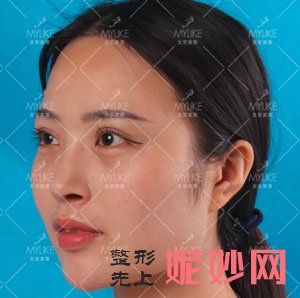北京美莱医疗美容医院谭章梅做眼综合整形的案例