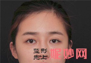北京沃尔医疗美容诊所的刘彦军做鼻部修复怎么样？案例对比效果图分享