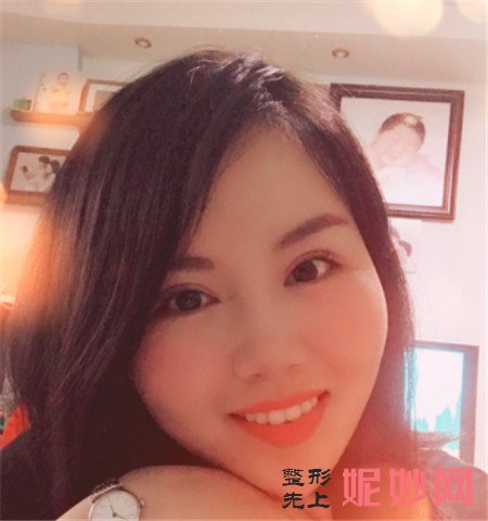 来看看北京丰科星范医疗美容门诊部的王咏民做除皱瘦脸的成功案例分享！