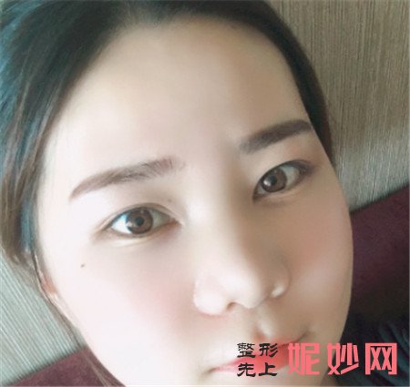 到上海时光找何晋龙医生做的V-LINE瓜子脸手术怎么样？真人案例分享