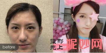 武汉华美是正规三甲医院吗?华美谭娜娜院长治疤痕怎么样?附案例效果_价格表