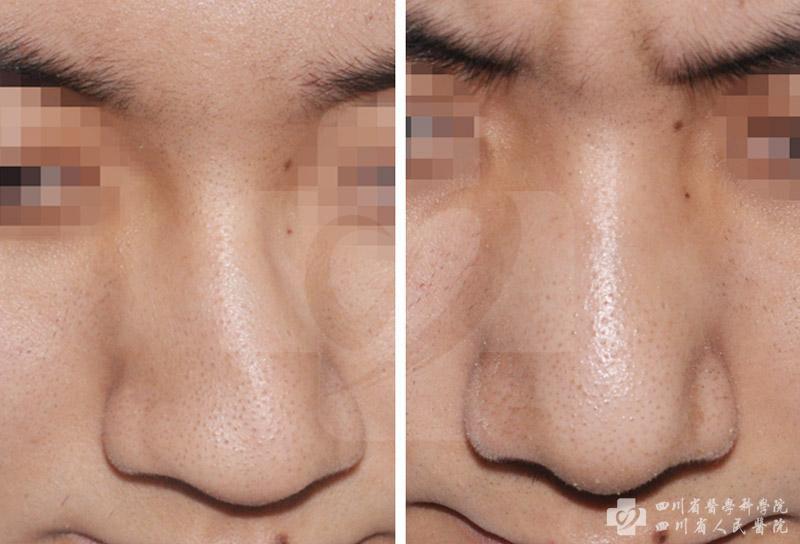 DSC_1676_副本_副本