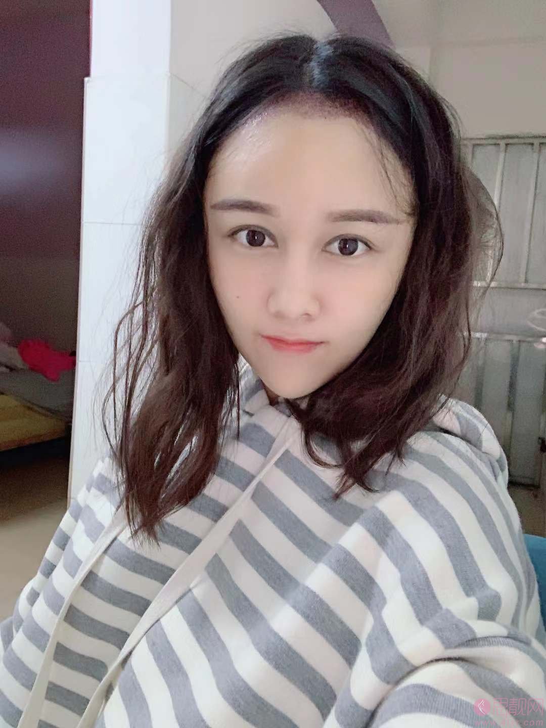 碧莲盛和雍禾哪个技术好?价格表曝光+真实案例效果对比