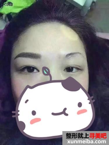 韩式半永久化妆术（韩式半永久纹眉）前后对比效果图片分享