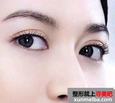 北京做双眼皮有哪几种办法？双眼皮的“前世今生”